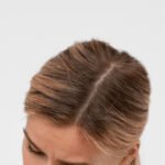 Női hajhullás okai és bevált hajnövesztő szerek