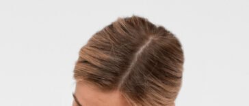 Női hajhullás okai és bevált hajnövesztő szerek